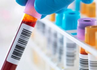 രക്തം ശുദ്ധിയായി സൂക്ഷിക്കാൻ ഇതാ 10 വഴികൾ