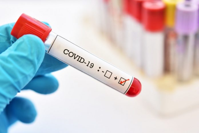 covid-testing_1024_683