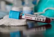 കോവിഡ് ബാധിച്ച് മലയാളി നഴ്സ് കുവൈറ്റിൽ മരിച്ചു