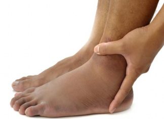 കാലില് നീര് കൂടുന്നുവോ; സാധാരണമായ ഒന്നാണ് എന്ന് പറഞ്ഞ് തള്ളിക്കളയരുത്