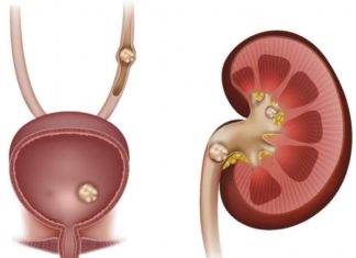 เดเดฟเดกเตเดจเดฟ เดธเตเดฑเตเดฑเตเตบ: เด
เดฑเดฟเดเตเดเดฟเดฐเดฟเดเตเดเดฃเด เด เดฒเดเตเดทเดฃเดเตเดเตพ