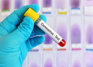 കോവിഡ് ലക്ഷണങ്ങളില് മൂന്നു പുതിയ ശാരീരികാവസ്ഥകള് കൂടി ഉള്പ്പെടുത്തി