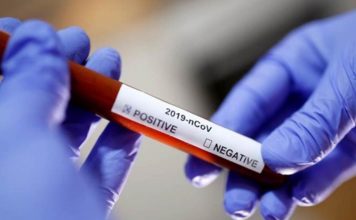 ലോകത്ത് കൊവിഡ് ബാധിതരുടെ എണ്ണം 7,451,532 ആയി