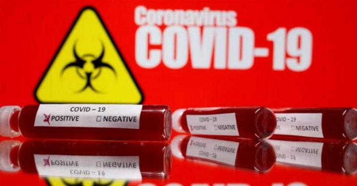 covid-19-750x391_1024_534