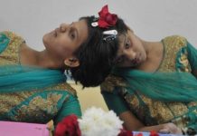 സംയോജിത ഇരട്ടസഹോദരിമാരായ വീണയ്ക്കും വാണിയ്ക്കും പത്താംക്ലാസിൽ മികച്ച വിജയം