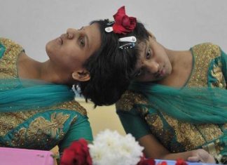 സംയോജിത ഇരട്ടസഹോദരിമാരായ വീണയ്ക്കും വാണിയ്ക്കും പത്താംക്ലാസിൽ മികച്ച വിജയം