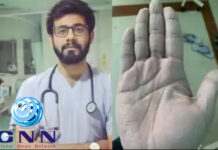 നീണ്ട പത്തു മണിക്കൂർ നേരം കോവിഡ് വാർഡിൽ ഗ്ലൗസ് ധരിച്ച് കോവിഡ് വാർഡിൽ; ഗ്ലൗസ് മാറ്റിയപ്പോൾ കണ്ടത്..