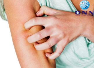 തൊലിപ്പുറത്തെ ഈ പ്രശ്നം കുട്ടികളെ ബാധിക്കുന്നത് എങ്ങനെ?