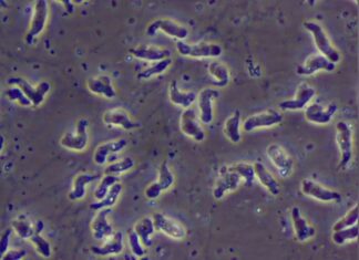 ടെക്സാസിലെ പൈപ്പുവെള്ളത്തില് തലച്ചോര് തീനിയായ സൂക്ഷ്മജീവി; പ്രദേശവാസികള്ക്ക് ജാഗ്രതാ നിര്ദേശം