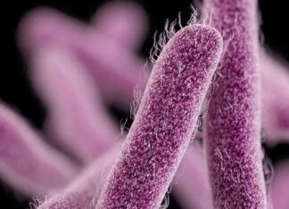 ഫറോക്ക് കല്ലമ്പാറയില് ഒന്നര വയസുകാരന് ഷിഗെല്ല സ്ഥിരീകരിച്ചു