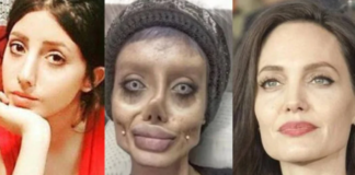 അഞ്ജലീന ജോളിയാവാന് സര്ജറി നടത്തി : ഇറാനി യുവതിക്ക് 10 വര്ഷം തടവ്