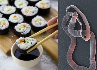 പഴകിയ സൂഷി കഴിച്ചു : യുവതിയുടെ വയറ്റില് ഒന്പത് മാസമായി വളരുന്ന നാടവിര