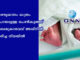 เดฐเดฃเตเดเตเดฎเดพเดธเด เดฎเดพเดคเตเดฐเด เดชเตเดฐเดพเดฏเดฎเตเดณเตเดณ เดชเตเตบเดเตเดเตเดเต เดฎเตเดเตเดฐเตเดตเตเดตเต เด
เดตเตเดจเดฟเตฝ เดฎเดฐเดฟเดเตเด เดจเดฟเดฒเดฏเดฟเตฝ