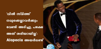 ‘വിൽ സ്മിത്ത് നമുക്കെല്ലാവർക്കും വേണ്ടി അടിച്ചു, പക്ഷേ അത് ശരിയായില്ല’: Alopecia അയർലണ്ട്