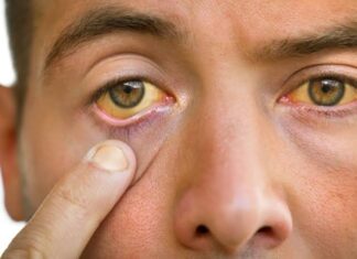 เดฎเดเตเดเดชเตเดชเดฟเดคเตเดคเด เดเดณเตเดณ เดเดณเตเดเต เดเดฃเตเดฃเดฟเดจเต เดฎเดเตเด เดจเดฟเดฑเด เดเดฃเตเดเดพเดตเดพเตป เดเดพเดฐเดฃเด เดเดจเตเดคเต?