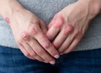 เดธเตเดฑเดฟเดฏเดพเดธเดฟเดธเดฟเดจเต เดชเตเดฐเดคเดฟเดตเดฟเดงเดฟ