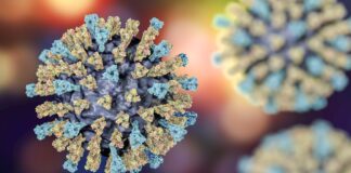 ലെയിൻസ്റ്ററിൽ മീസിൽസ് ബാധിച്ച് ഒരാൾ മരിച്ചു; അതീവ ജാഗ്രതാ നിർദേശം