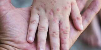 เด
เดฏเตผเดฒเดฃเตเดเดฟเตฝ เดชเตเดคเดฟเดฏ เดฎเตเดธเดฟเตฝเดธเต เดเตเดธเตเดเตพ เดฑเดฟเดชเตเดชเตเตผเดเตเดเต เดเตเดฏเตเดคเต