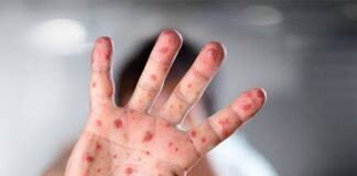 เดกเดฌเตเดฒเดฟเดจเดฟเดฒเตเดคเตเดคเดฟเดฏ เดตเดฟเดฎเดพเดจ เดฏเดพเดคเตเดฐเดเตเดเดพเดฐเดจเต เดฎเตเดธเดฟเตฝเดธเต เดธเตเดฅเดฟเดฐเตเดเดฐเดฟเดเตเดเต; เดธเดน เดฏเดพเดคเตเดฐเดเตเดเดพเตผเดเตเดเต เดฎเตเดจเตเดจเดฑเดฟเดฏเดฟเดชเตเดชเต