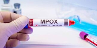 เด
เดฏเตผเดฒเดฃเตเดเดฟเตฝ เดเดฆเตเดฏ Clade I mpox เดเตเดธเต เดธเตเดฅเดฟเดฐเตเดเดฐเดฟเดเตเดเต