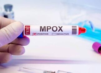 เด
เดฏเตผเดฒเดฃเตเดเดฟเตฝ เดเดฆเตเดฏ Clade I mpox เดเตเดธเต เดธเตเดฅเดฟเดฐเตเดเดฐเดฟเดเตเดเต