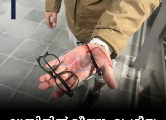 ഡബ്ലിനിൽ വീണ്ടും വംശീയ ആക്രമണം; ഇന്ത്യൻ യുവാവിന് ഗുരുതര പരിക്ക്