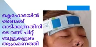 ഒക്ലഹോമയിൽ ബൈക്ക് ഓടിക്കുന്നതിനിടെ രണ്ട് പിറ്റ് ബുളുകളുടെ ആക്രമണത്തിൽ സ്ത്രീയുടെ കൈകാലുകൾ നഷ്ടപ്പെട്ടു