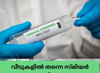 വീടുകളിൽ തന്നെ സ്മിയർ ടെസ്റ്റുകൾ നടത്താം; CervicalCheck അടുത്ത വർഷം മുതൽ