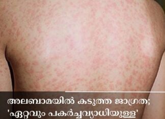 അലബാമയിൽ കടുത്ത ജാഗ്രത; ‘ഏറ്റവും പകർച്ചവ്യാധിയുള്ള’ അഞ്ചാംപനി രോഗം പടരുന്നു