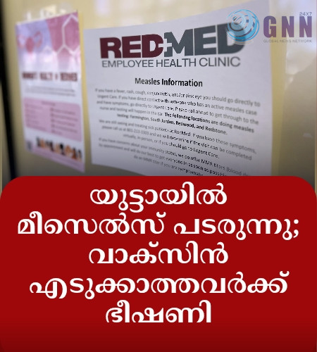 യുട്ടായിൽ മീസെൽസ് പടരുന്നു; വാക്സിൻ എടുക്കാത്തവർക്ക് ഭീഷണി