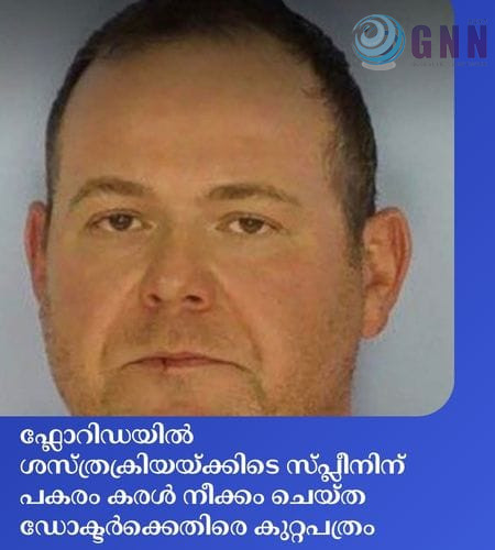 ഫ്ലോറിഡയിൽ ശസ്ത്രക്രിയയ്ക്കിടെ സ്പ്ലീനിന് പകരം കരൾ നീക്കം ചെയ്ത ഡോക്ടർക്കെതിരെ കുറ്റപത്രം