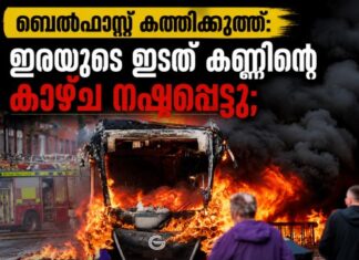 ബെൽഫാസ്റ്റ് കത്തിക്കുത്ത്: ഇരയുടെ ഇടത് കണ്ണിന്റെ കാഴ്ച നഷ്ടപ്പെട്ടു; വടക്കൻ അയർലണ്ടിൽ കുടിയേറ്റ വിരുദ്ധ പ്രതിഷേധം അക്രമാസക്തം